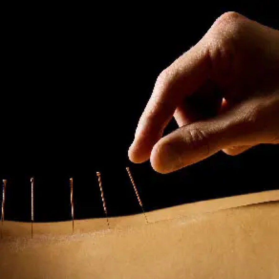 drsarmiento_home_tratamientos_acupuntura