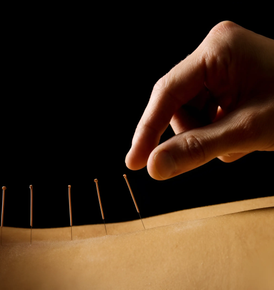 drsarmiento_tratamientos_acupuntura_x